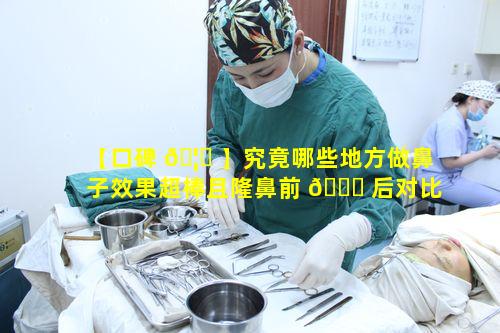 【口碑 🦉 】究竟哪些地方做鼻子效果超棒且隆鼻前 🕊 后对比显著呢